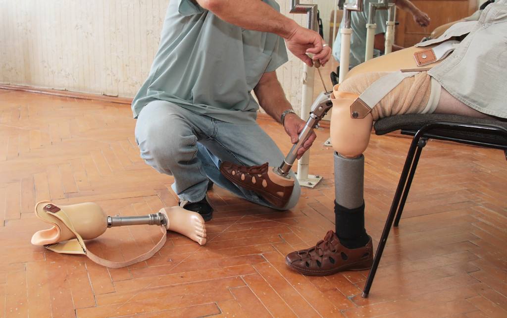 假肢厂家分享安装小腿假肢知识(图1)