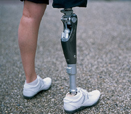 截肢患者使用小腿假肢过程中要注意哪些细节(图1)